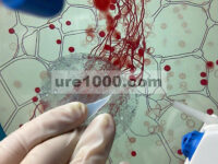 Sinergisme Hidrogel yang Diaktifkan oleh Metabolisme-Eferositosis Memprogram Ulang Lingkungan Mikro Imun untuk Meningkatkan Perbaikan Luka Diabetes